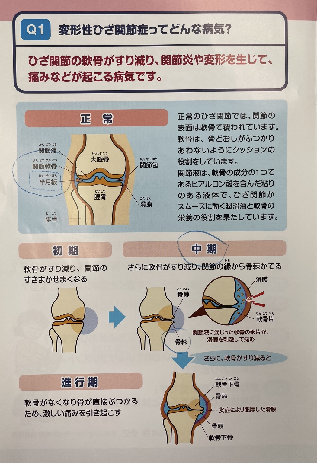 その後の社長の左膝